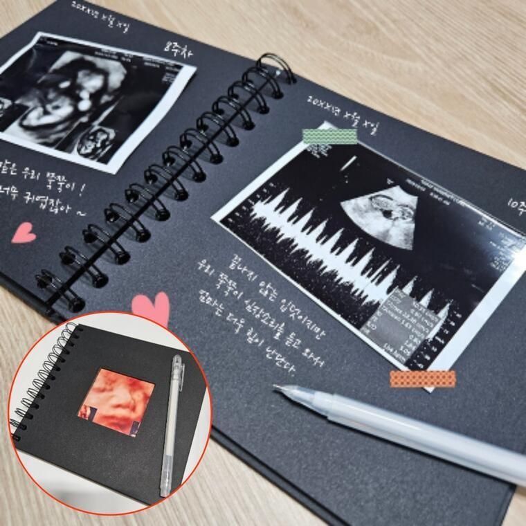 초음파 사진 태교 다이어리 신생아 임신 기록 추억 엄마 감성 아기 성장